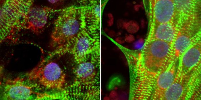 Diabetes in Pregnancy Prevents Healthy Heart Growth