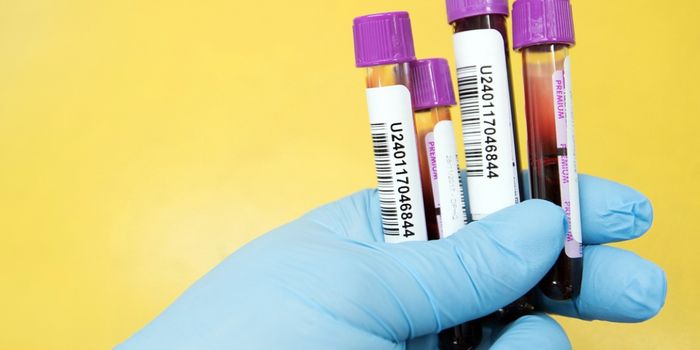 DNA Methylation Patterns may Work as Parkinson's Biomarkers