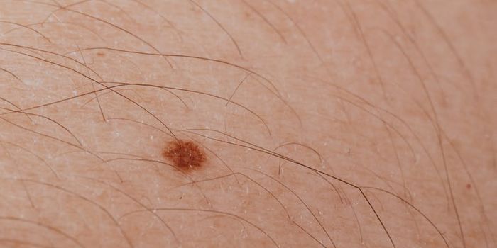 New device detects skin cancer from tensile stiffness