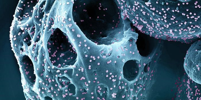 Neanderthal Variants & Hookworm Exposure - Intriguing Influences on COVID-19 Severity