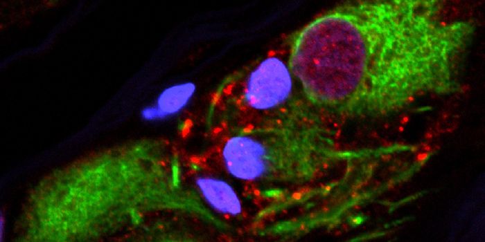 Researchers Link Parkinson's Disease and the Appendix