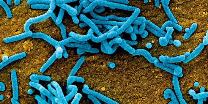 Marburg Virus Kills 9 in Equatorial Guinea's First Outbreak