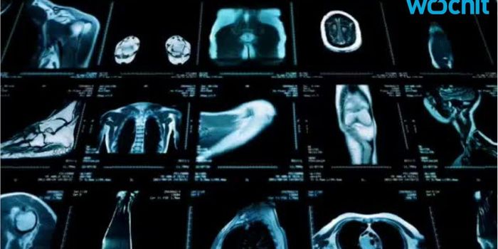 Health Insurance and Cancer Outcomes