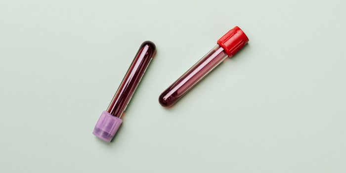 Routine Blood Test May Show Link Between Schizophrenia and Cardiovascular Disease