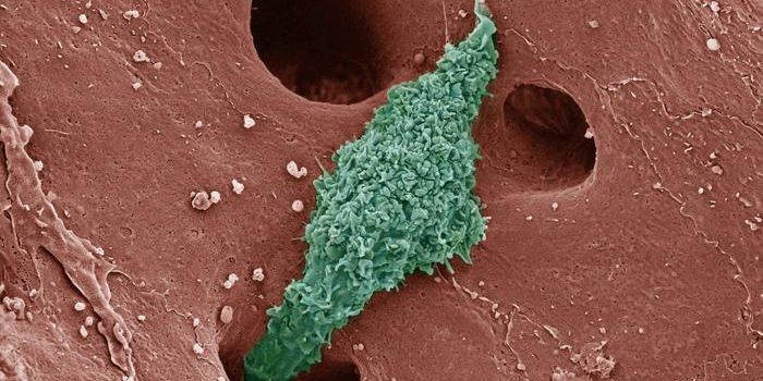 A Name Change & New Insights for a Common Type of Liver Disease