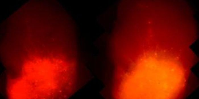 Advances in Cancer Research Through Organoids