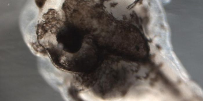 Artificial Intelligence Provides Cancer Insights