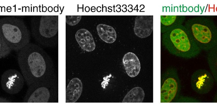 New Probe Detects Histone Modifications in Live Cells