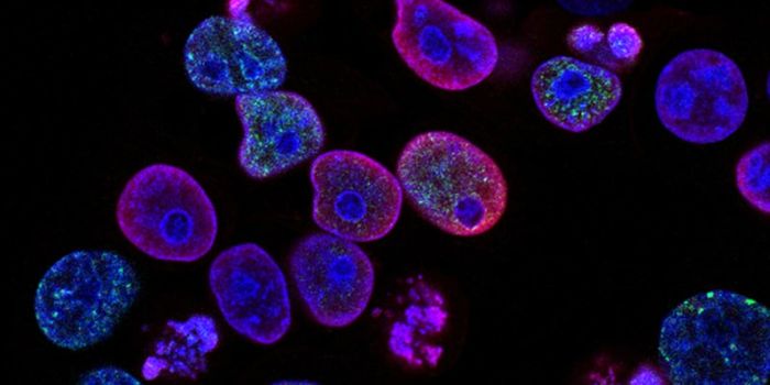 The Power of Extracellular Vesicles