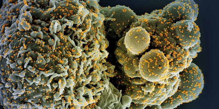 COVID-19 Disrupts Mitochondrial Function in Heart, Other Organs