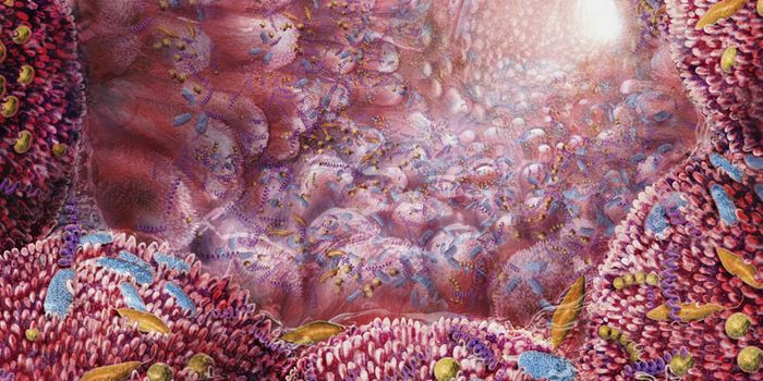 A Diet that Shifts Colon Cancer Bacteria in Your Favor