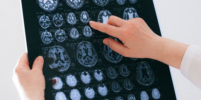 Antidepressants and Anti-epileptics During Pregnancy May Affect Infant Brain Development