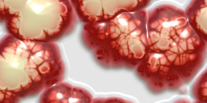 Anticoagulant Drugs Prevent Cancer Spreading to Brain