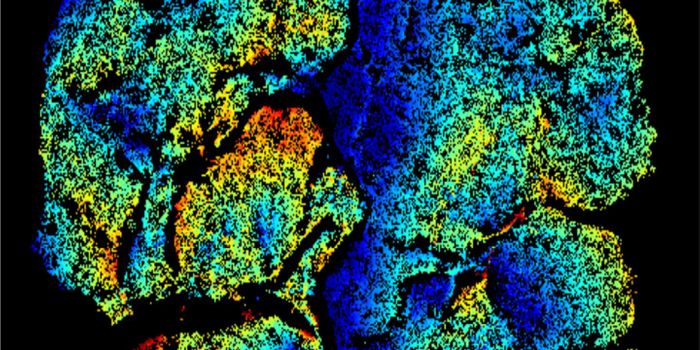 Explaining Slow Recovery from Bone Marrow Transplants