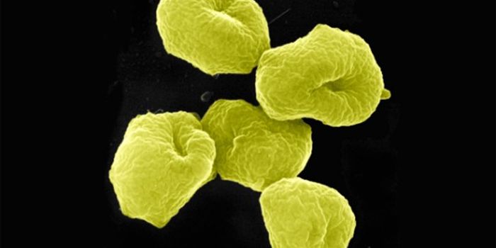 Better Know a Microbe: Archaea