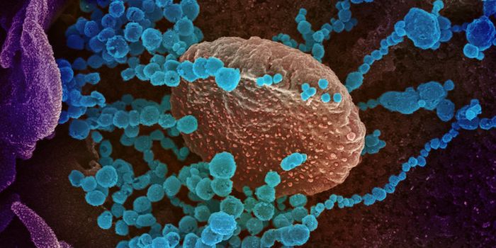 SARS-CoV-2 Disrupts the Blood Brain Barrier