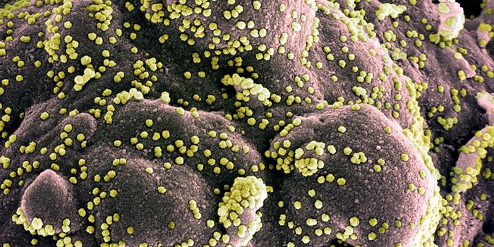 Johns Hopkins is Starting COVID-19 Plasma Trials