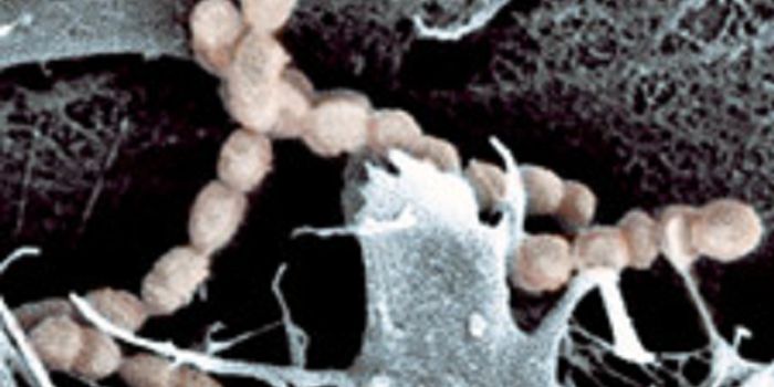 A Potential Target for Treating Toxic Shock Syndrome