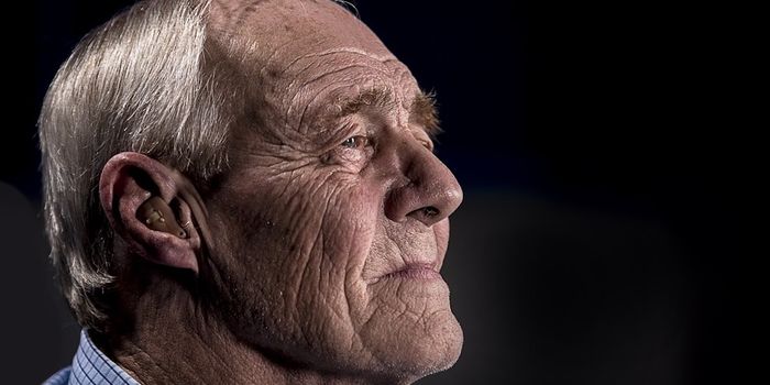 Familial Alzheimer's Gene Found to Regulate Nerve Development