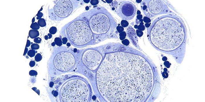 Blood Leaking Fibrinogen Is the Cause of Multiple Neurological Diseases