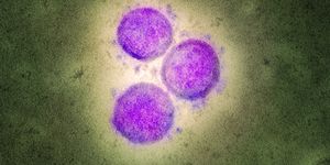 A Mother-to-Fetus COVID-19 Transmission Has Devastating Consequences