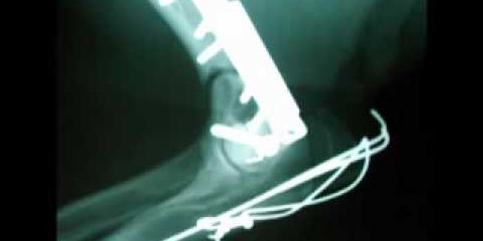 Small Pins and Wires