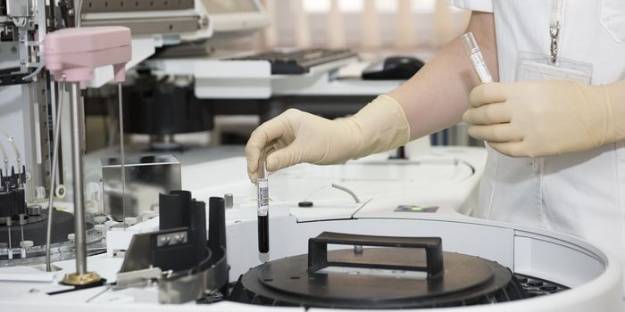 Sherlock's DNA biosensors set to make diagnostics elementary