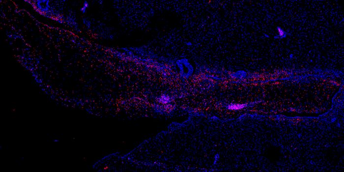 Even After Treatment, Ebola May Persist in the Brain