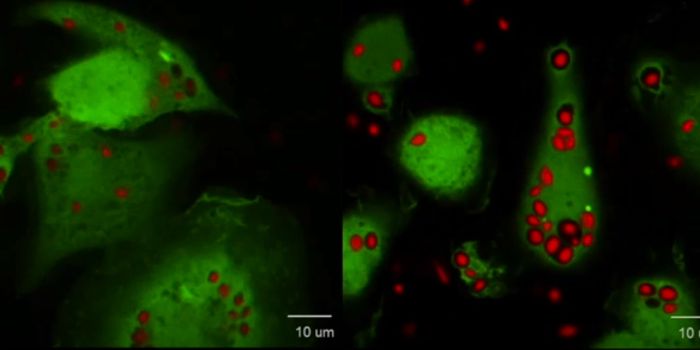 Scientists Finally Figure Out How Immune Cells Release IL-1