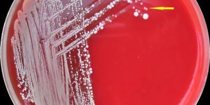 How do bacteria evolve in the lungs of CF patients?