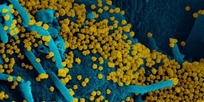 It Seems Not All COVID-19 Patients Develop Antibodies