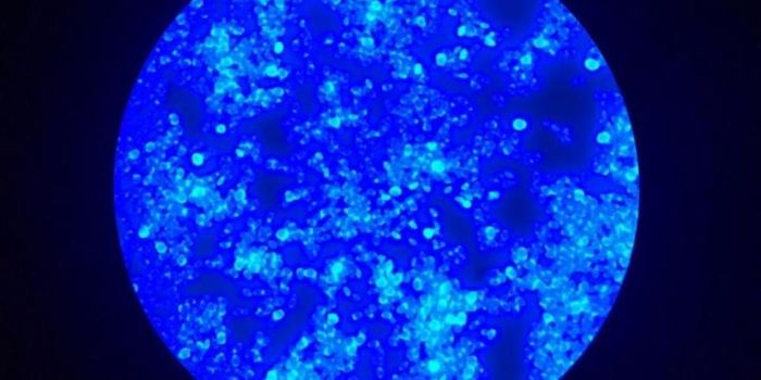 COVID-19 Gives Dangerous Fungal Infections an Opening