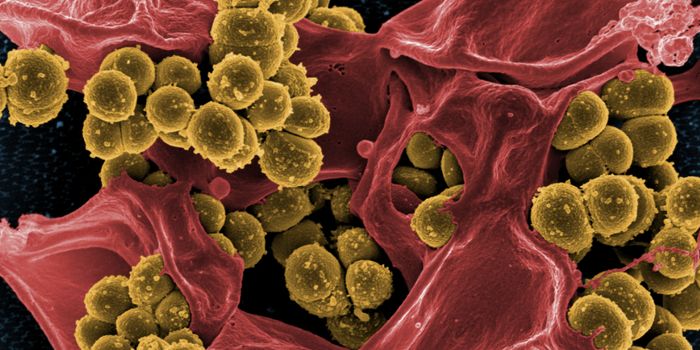 Cleansers, Antibiotics may Contribute to Growth of MRSA in the Home