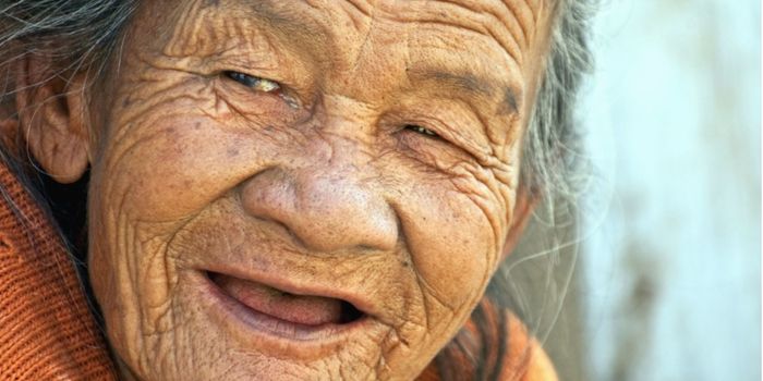 A Possible Treatment Strategy for Familial Alzheimer's is ID'ed