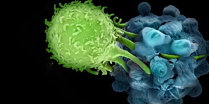 New Imaging Tech Predicts Early Immunotherapy Response