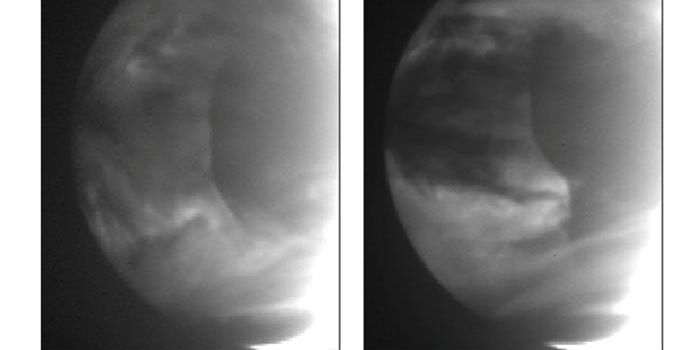 Venus Clouds Driven by Solar System's Largest Waves