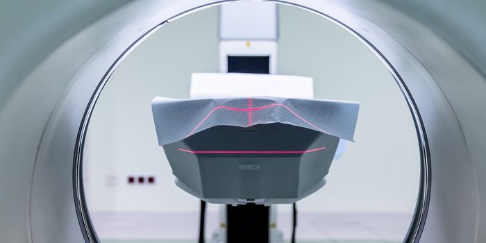 Following Platelets to Diagnose Myocarditis