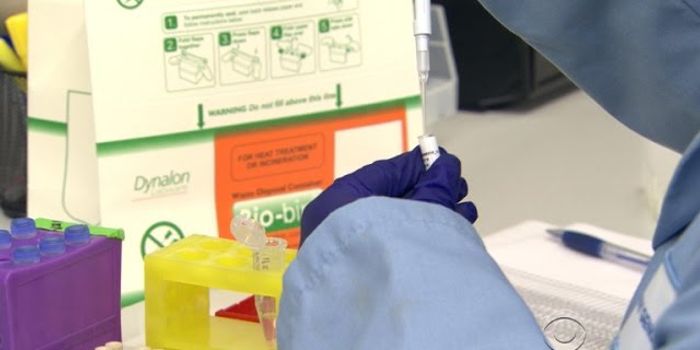 Is the Liquid Biopsy Really Accurate?