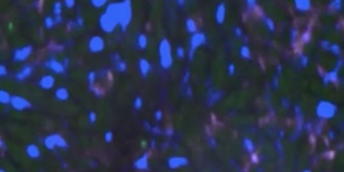 Revealing why Sepsis Causes Organs to Fail