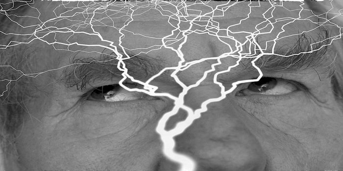 Researchers Pinpoint Neurons Affected by Epilepsy