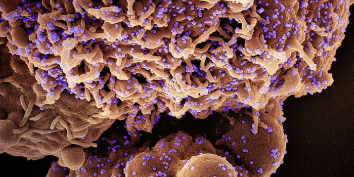 A Potential Cause of Long COVID is Identified