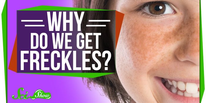 Why Some Faces Have Freckles While Others Don