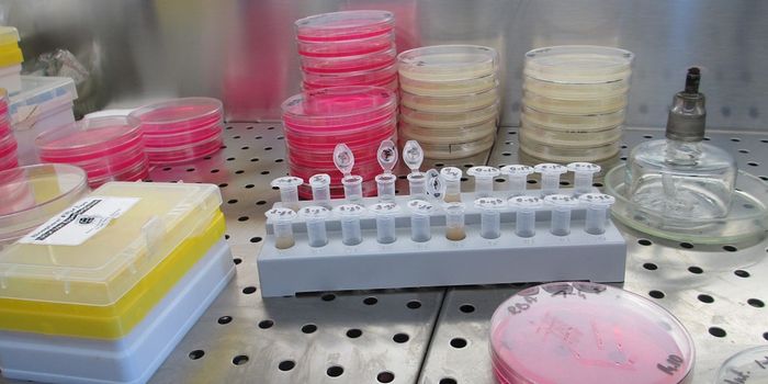 Using organoids to improve chemotherapy for advanced stages of colon and appendiceal cancer