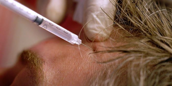 A Toxin that Smooths Wrinkles Also Treats Chronic Migraines