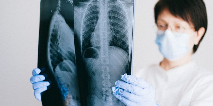 Lab-Created Mini Lungs to Study Infections