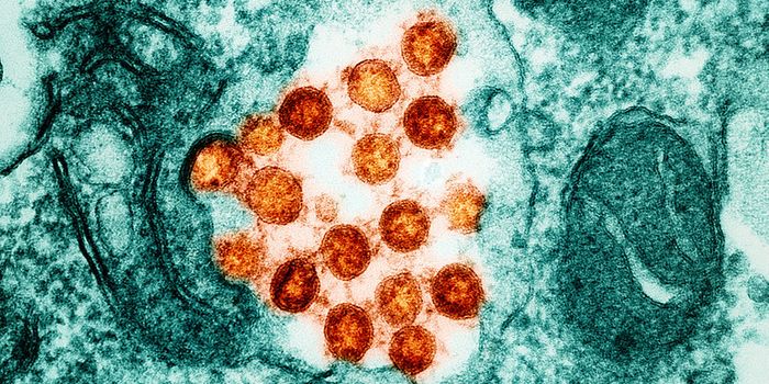 Revealing the Cause of Long COVID-Associated Fatigue