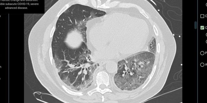 Imaging Platform to Aid in Diagnosis of COVID-19