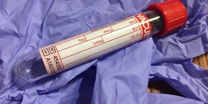 Is a multi-cancer detection blood test safe for women?