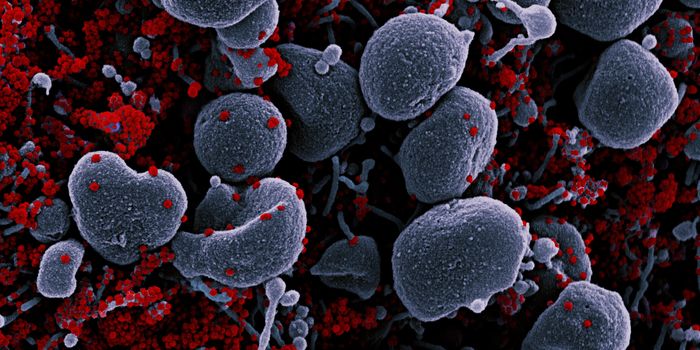 COVID-19 May Cause Diabetes