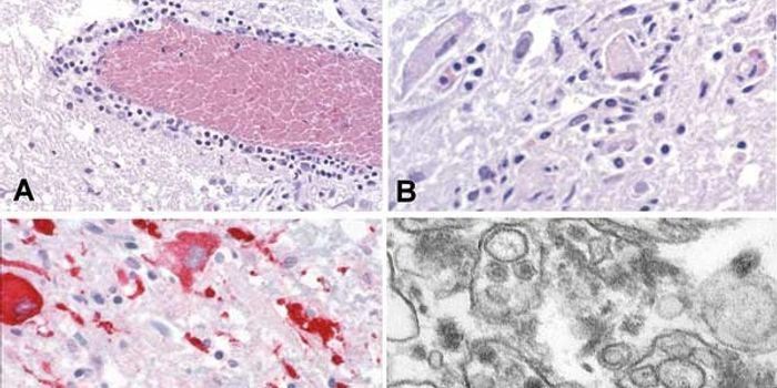 Climate Change Leads to Rapid Emergence of Infectious Diseases, Study Finds